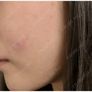 KM新宿クリニック口コミ