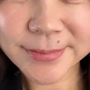 福岡TAクリニック口コミ