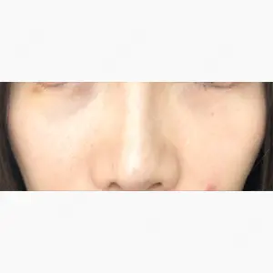 千葉美容外科アイビークリニック口コミ