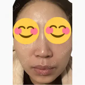 美容皮膚科エルムクリニック 麻布院口コミ