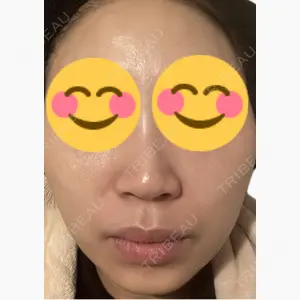 美容皮膚科エルムクリニック 麻布院口コミ