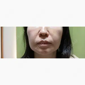 BIZENNクリニック【ビゼンクリニック】口コミ