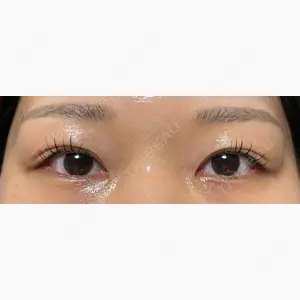 オジスキンクリニック口コミ