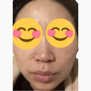 美容皮膚科エルムクリニック 麻布院口コミ