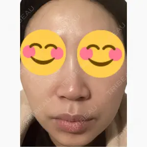 美容皮膚科エルムクリニック 麻布院口コミ