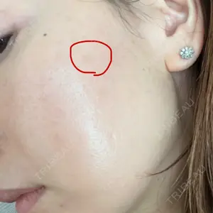 APスキンクリニック銀座口コミ