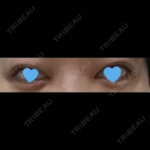 札幌美容外科ネビュラクリニック口コミ