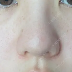 PRISM Beauty Clinic 新宿院口コミ