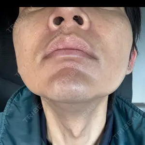 湘南美容クリニック 豊田院口コミ