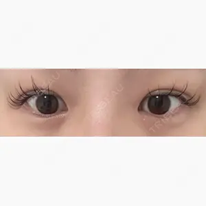 MIYAフェイスクリニック口コミ