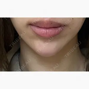 Zetith Beauty Clinic 大阪心斎橋院口コミ