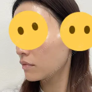 東京美容外科 沖縄院口コミ