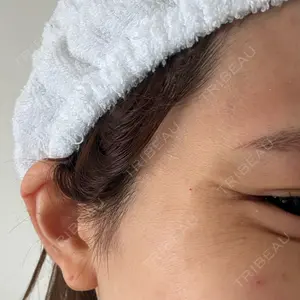 TCB東京中央美容外科 広島院口コミ