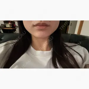 小暮整形外科・美容外科口コミ