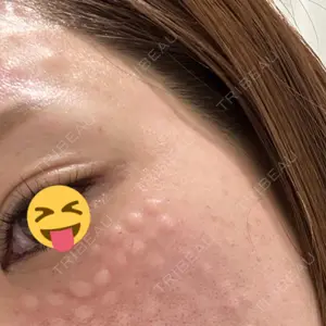 NARU Beauty Clinic 【ナルクリ】 水戸院口コミ