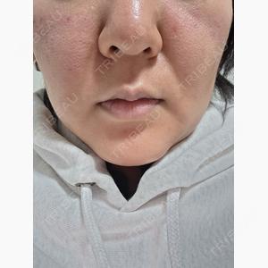 BELINDA CLINIC（ベリンダクリニック）柏院口コミ