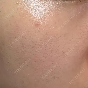 ルラ美容クリニック 神戸院口コミ