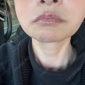 ルラ美容クリニック 上野院口コミ