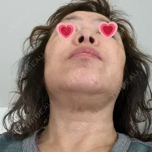 サラ美容外科口コミ