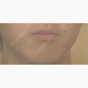 Ledian Clinic六本木口コミ