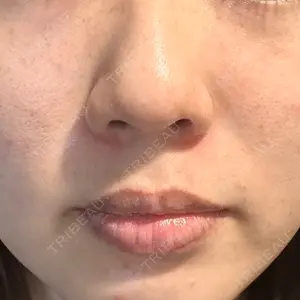 東京美容外科 福岡院口コミ