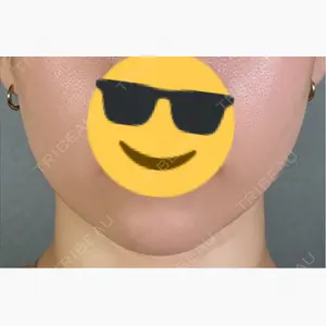 アリエル美容クリニック 郡山院口コミ