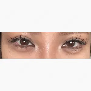 共立美容外科 京都院口コミ