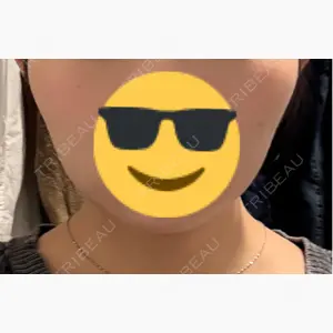 共立美容外科 梅田院口コミ