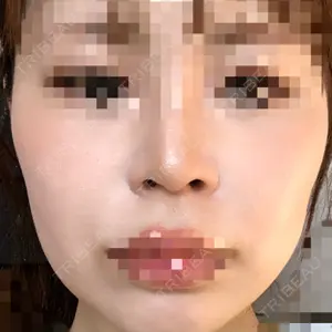 表参道スキンクリニック 大阪院口コミ