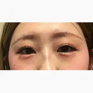 ルラ美容クリニック 宇都宮院口コミ