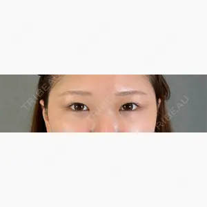 アリエル美容クリニック 郡山院口コミ