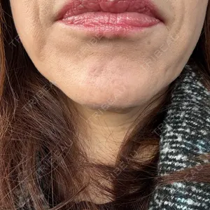 アネシス美容クリニック口コミ