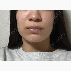 ルラ美容クリニック 宇都宮院口コミ