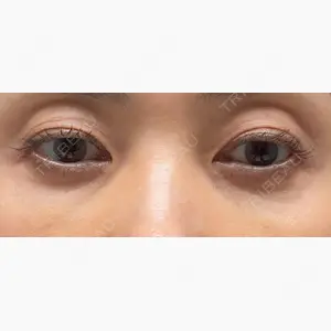 札幌美容外科ネビュラクリニック口コミ