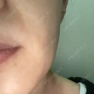 YBC横浜美容外科 立川院口コミ