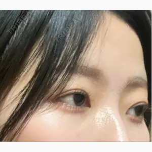 LUHO（ルホ）美容外科口コミ