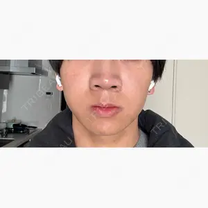 東京美容外科 新宿院口コミ