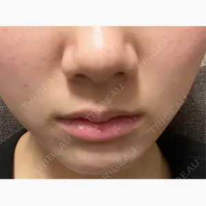 おおたかの森ビューティークリニック口コミ