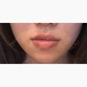 メディカルアルファクリニック口コミ