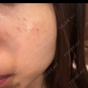 ルラ美容クリニック 大阪本院口コミ