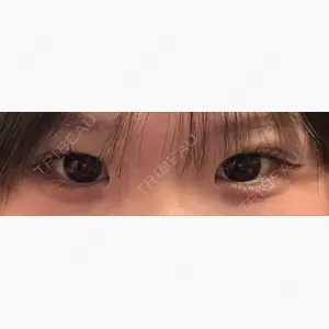 アリエル美容クリニック 水戸院口コミ