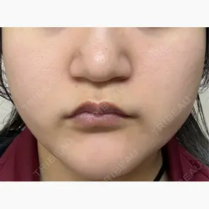 東京シルククリニック 東京神田院口コミ