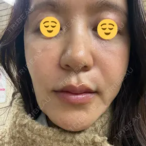 PRO CLINIC プロクリニック 銀座院口コミ