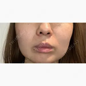 共立美容外科 梅田院口コミ