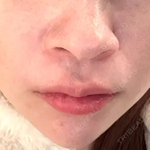 Re:anne clinic 銀座 【リアンクリニック銀座】口コミ