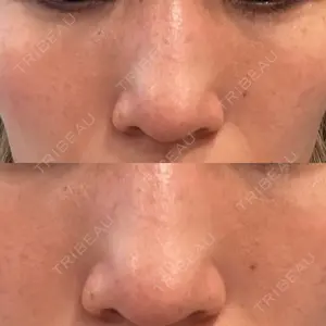 ルラ美容クリニック 札幌大通り院口コミ