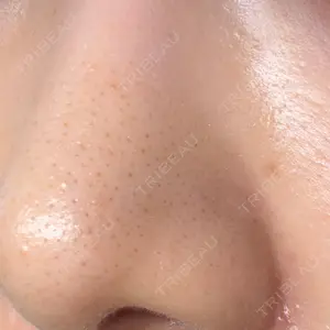 Zetith Beauty Clinic 大阪心斎橋院口コミ