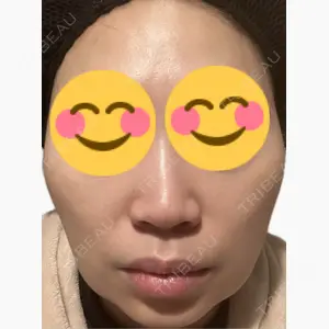 美容皮膚科エルムクリニック 麻布院口コミ