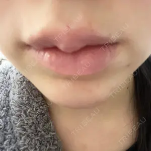 ルラ美容クリニック 渋谷本院口コミ