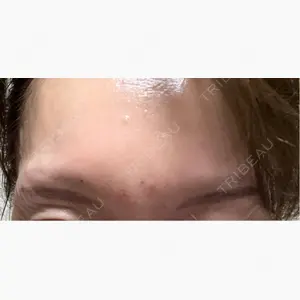 NARU Beauty Clinic 【ナルクリ】 水戸院口コミ